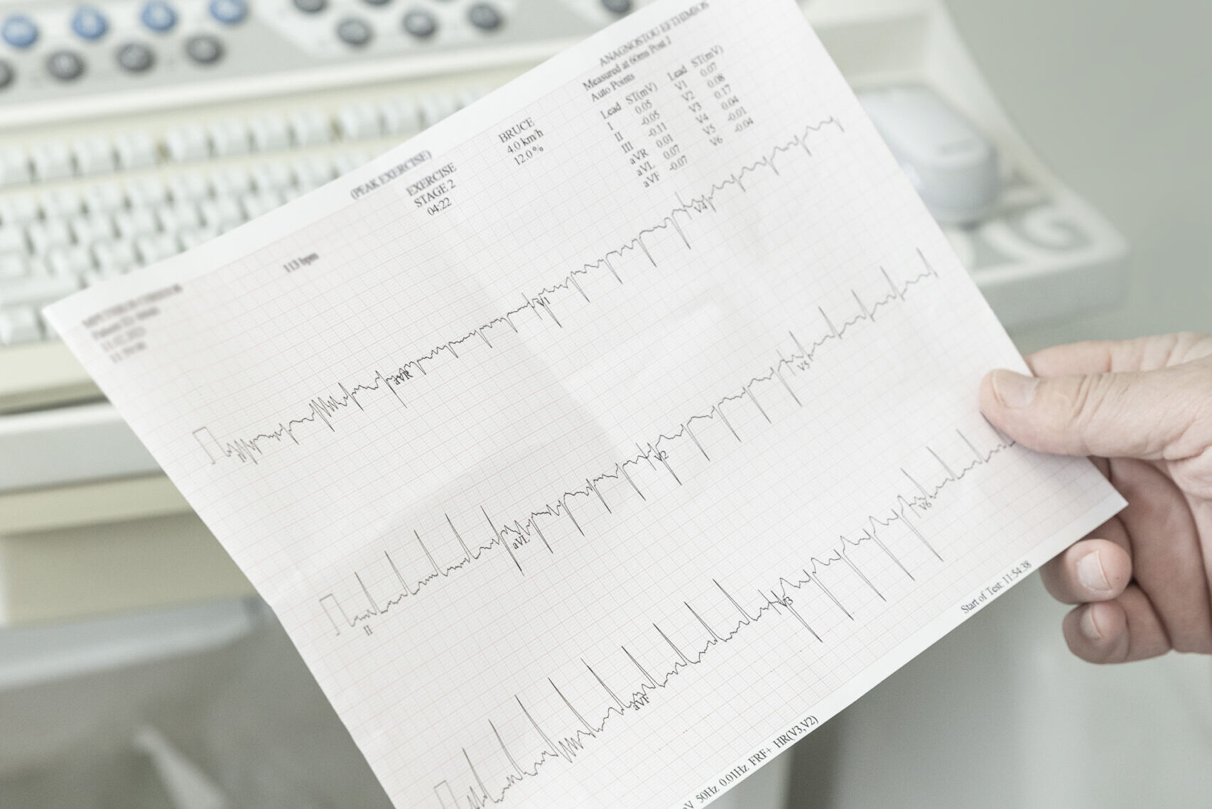 ΗΛΕΚΤΡΟΚΑΡΔΙΟΓΡΑΦΗΜΑ